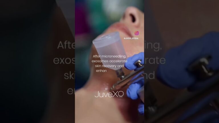 ✨Looking for faster recovery after microneedling?